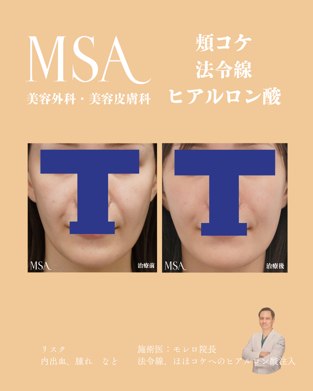 メニュー