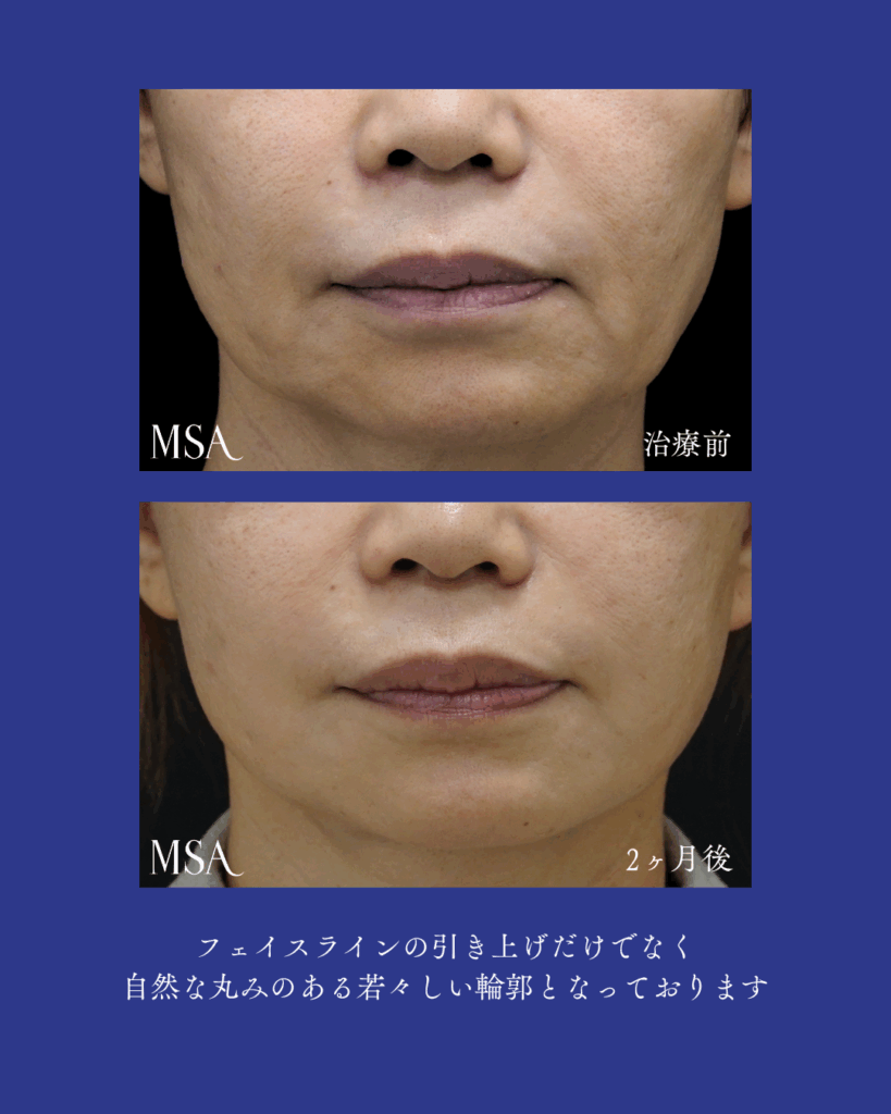 顔面の美容外科 Basic &amp; Advance(PEPARS(ペパーズ) No.195(2023年3月増大号)) Amazon.com: 顔面の美容外科 Basic & Advance(PEPARS(ペパーズ