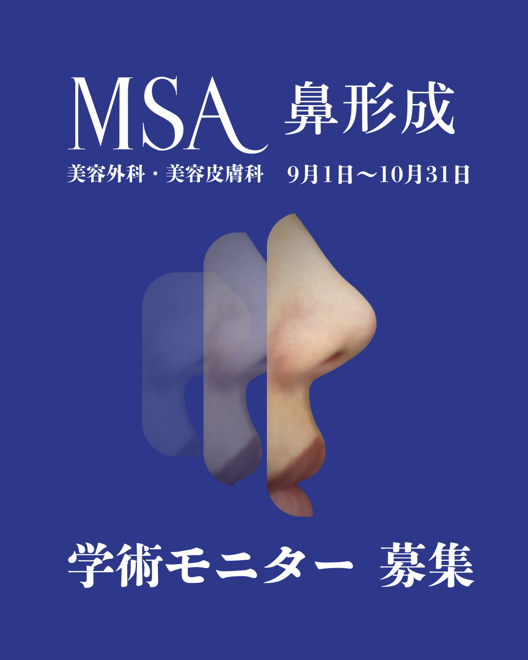 ニュース